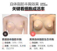 昭通做自體脂肪豐胸，怎么提高脂肪存活率