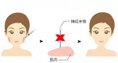 成都打瘦臉針的效果能夠維持多長時(shí)間