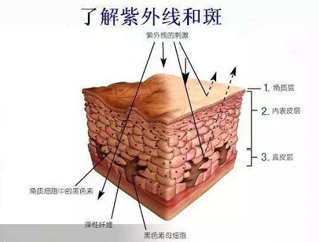 激光祛日曬斑費用多少