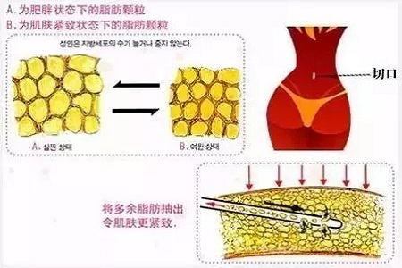 四月不吸脂，五、六、七月徒傷悲......