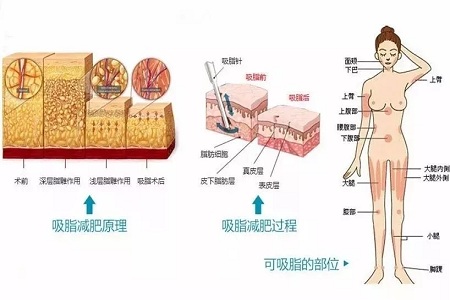 四月不吸脂，五、六、七月徒傷悲......