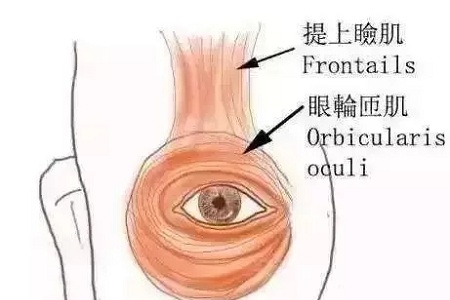 做了雙眼皮，醫師為什么建議要多睜眼？