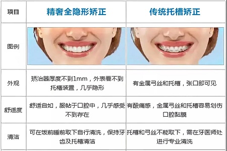 這種牙齒矯正方式，96%的人都會選擇！