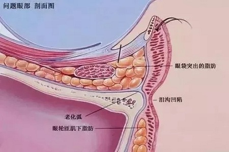 顯老淚溝，你還要任其放肆嗎？