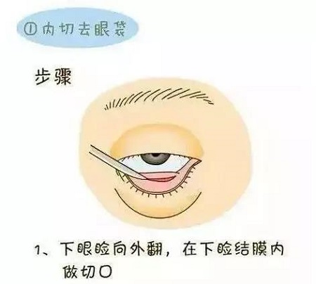 眼袋