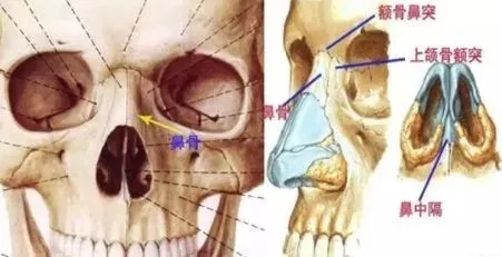 側面看鼻梁不矮,正面看鼻子卻很塌是什么原因？