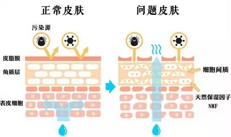 去掉痘痘