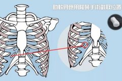 深圳隆鼻醫院做軟骨隆鼻多少錢，術后安全嗎